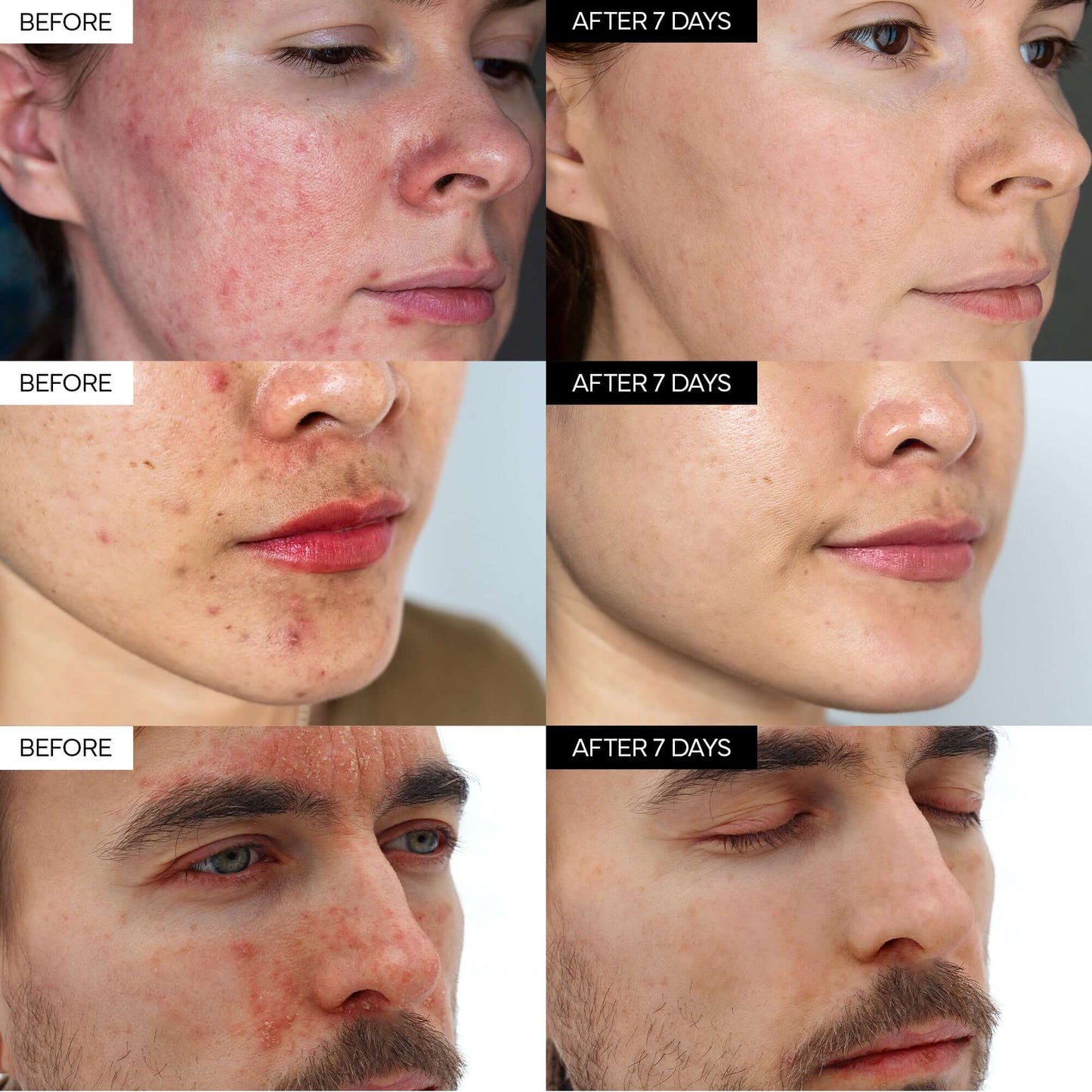 ✨Intensive Cica Repair Cream