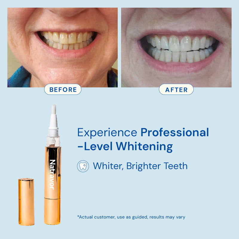 🔥Buy 1 get 1 free Extra-Strength Teeth Whitening Serum Pen + Dual-Peroxide Formula & Xylitol