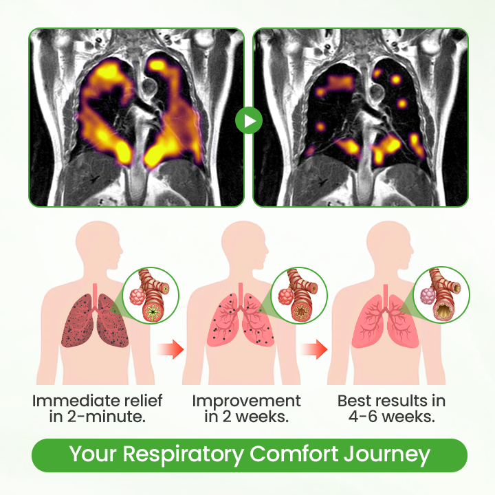 🔥🔥Natravor™ HerbaAir Mullein Lung Purifier (new)