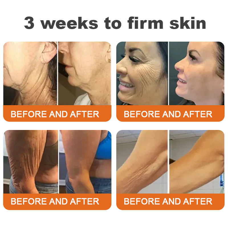 🔥🔥Natravor™ Botox Bee Venom Firming Serum Stick LAST DAY 70% OFF