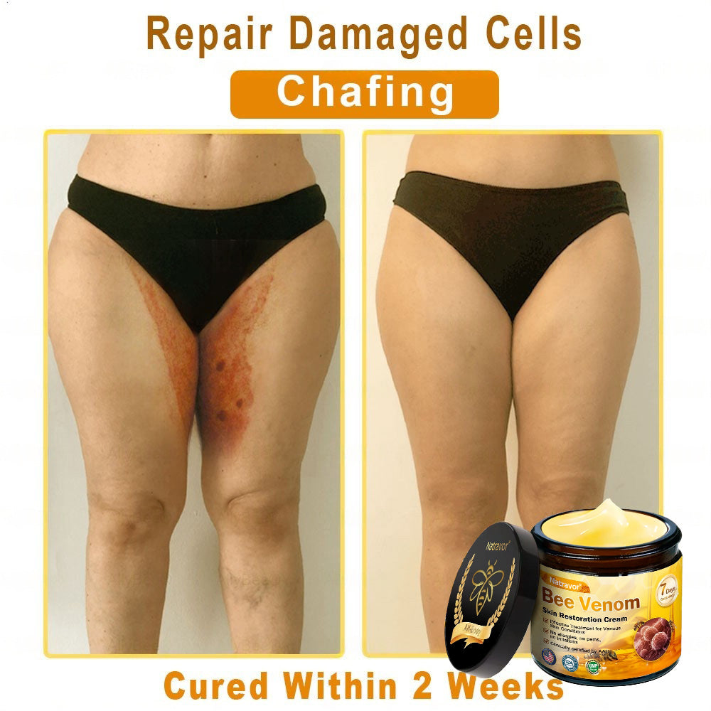 Dermatology Official: Natravor® Skin Treatment Cream Anti-aging, Hydrating, Skin Repair, Even Tone, Acne and Dark Spot Treatment, Wart and Mole Removal, Psoriasis Relief👍