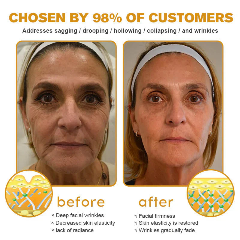 Dermatology Official: Natravor® Skin Treatment Cream Anti-aging, Hydrating, Skin Repair, Even Tone, Acne and Dark Spot Treatment, Wart and Mole Removal, Psoriasis Relief👍