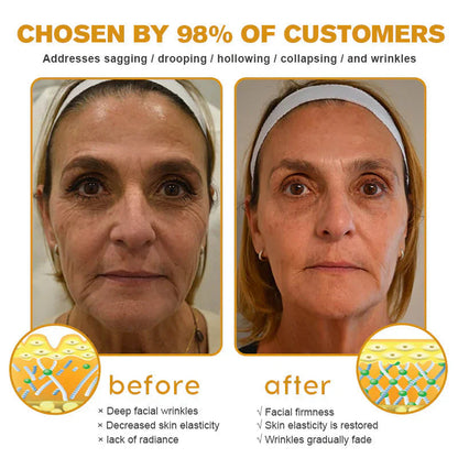 Dermatology Official: Natravor® Skin Treatment Cream Anti-aging, Hydrating, Skin Repair, Even Tone, Acne and Dark Spot Treatment, Wart and Mole Removal, Psoriasis Relief👍
