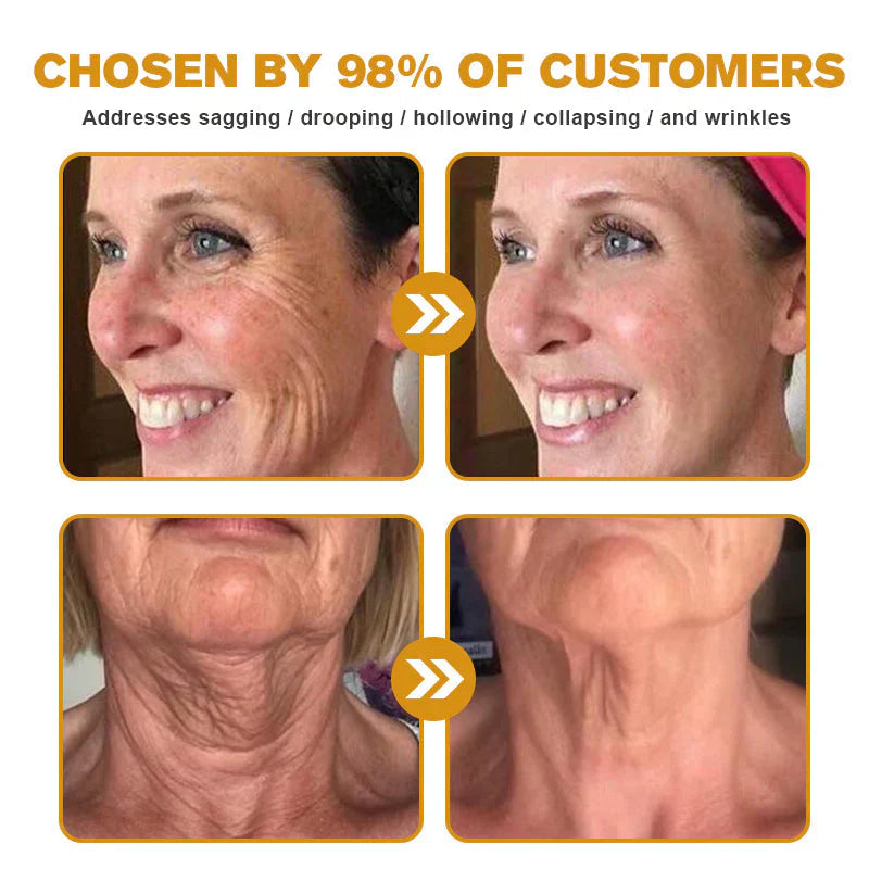 Dermatology Official: Natravor® Skin Treatment Cream Anti-aging, Hydrating, Skin Repair, Even Tone, Acne and Dark Spot Treatment, Wart and Mole Removal, Psoriasis Relief👍
