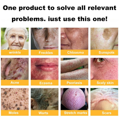 Dermatology Official: Natravor® Skin Treatment Cream Anti-aging, Hydrating, Skin Repair, Even Tone, Acne and Dark Spot Treatment, Wart and Mole Removal, Psoriasis Relief👍