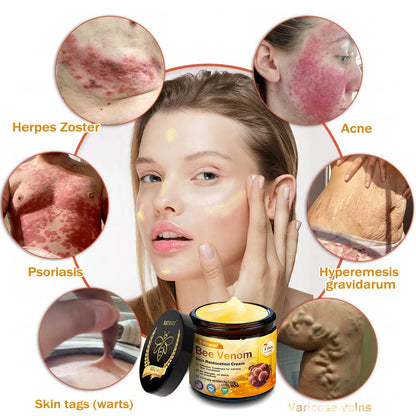 Dermatology Official: Natravor® Skin Treatment Cream Anti-aging, Hydrating, Skin Repair, Even Tone, Acne and Dark Spot Treatment, Wart and Mole Removal, Psoriasis Relief👍