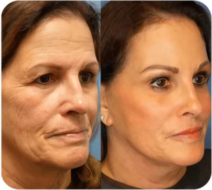 ✨Natravor™-Facial firming cream