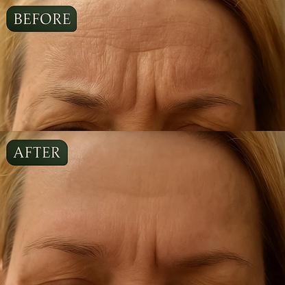 🔥🔥Dual Action Real Deep Collagen Sheets for both wrinkle smoothing and new or old scar fading-Natravor™