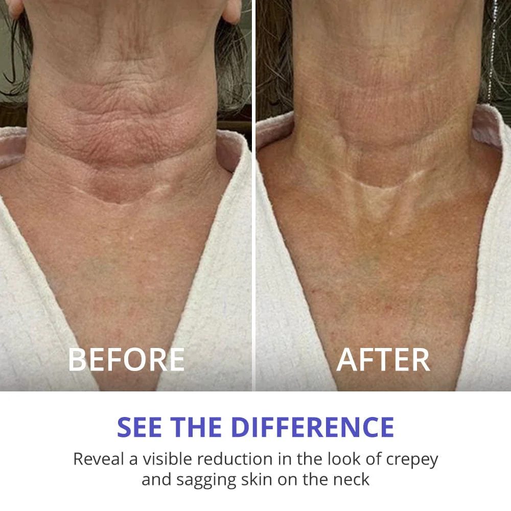 🔥🔥NATRAVOR Neck Glow Magic Cream