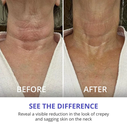 🔥🔥NATRAVOR Neck Glow Magic Cream