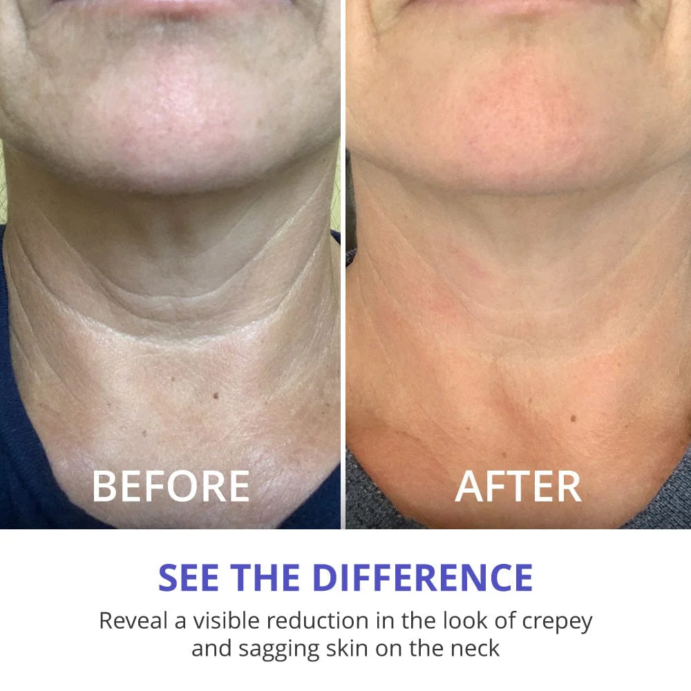 🔥🔥NATRAVOR Neck Glow Magic Cream