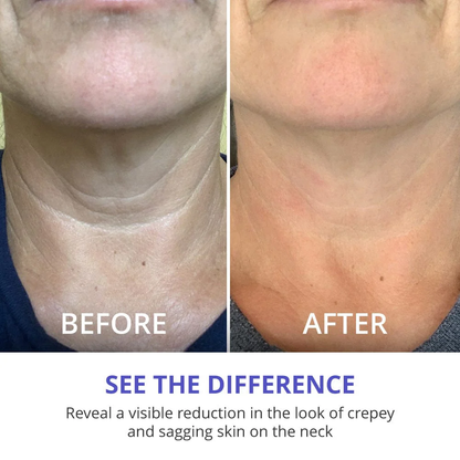 🔥🔥NATRAVOR Neck Glow Magic Cream