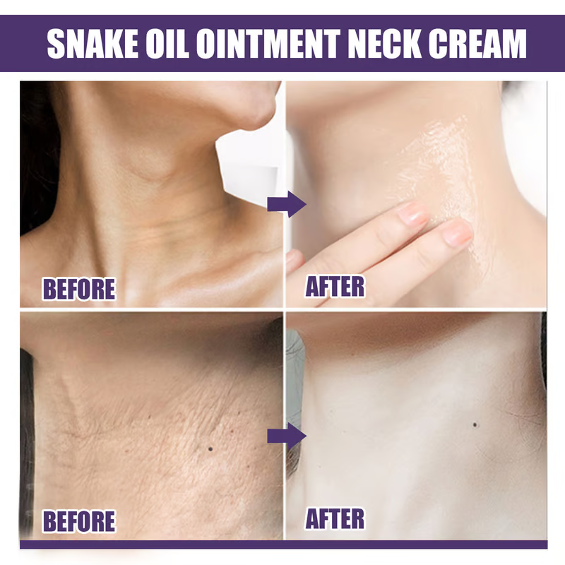 🔥🔥Oil-nourishing Firming Lifting Firming Neck Cream