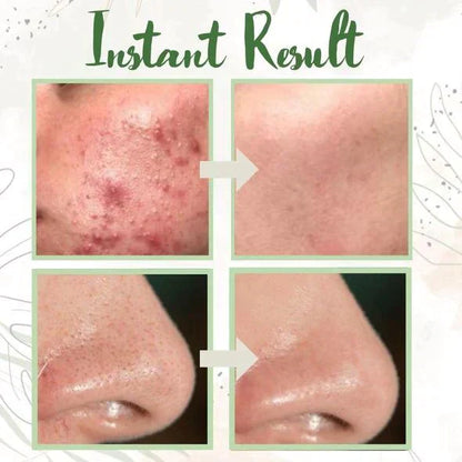 🔥🔥GREEN TEA MASK | DEEP PORE CLEANSER