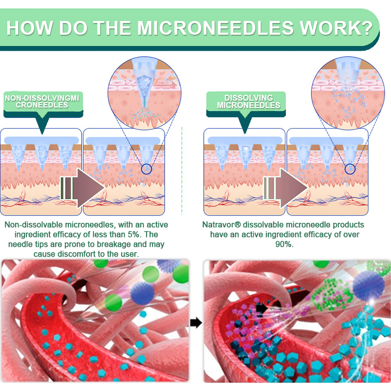 【Last Day Promotion 60% OFF❤️】Natravor® NIDDK-Tirzepatide Slimming & health NANO MICRONEEDLE PATCH👨‍⚕️（Zero Pain, 24/7 Release | Lose 20lbs FAST | 90% Sugar Drop | ）