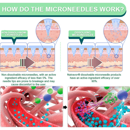 【Last Day Promotion 60% OFF❤️】Natravor® NIDDK-Tirzepatide Slimming & health NANO MICRONEEDLE PATCH👨‍⚕️（Zero Pain, 24/7 Release | Lose 20lbs FAST | 90% Sugar Drop | ）