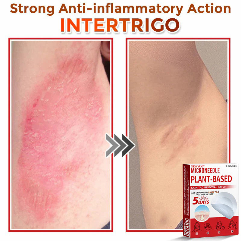🔥🔥Natravor™-MicroNeedle Plant-based Skin Tag Removal Patch 🇺🇸 Made in the USA