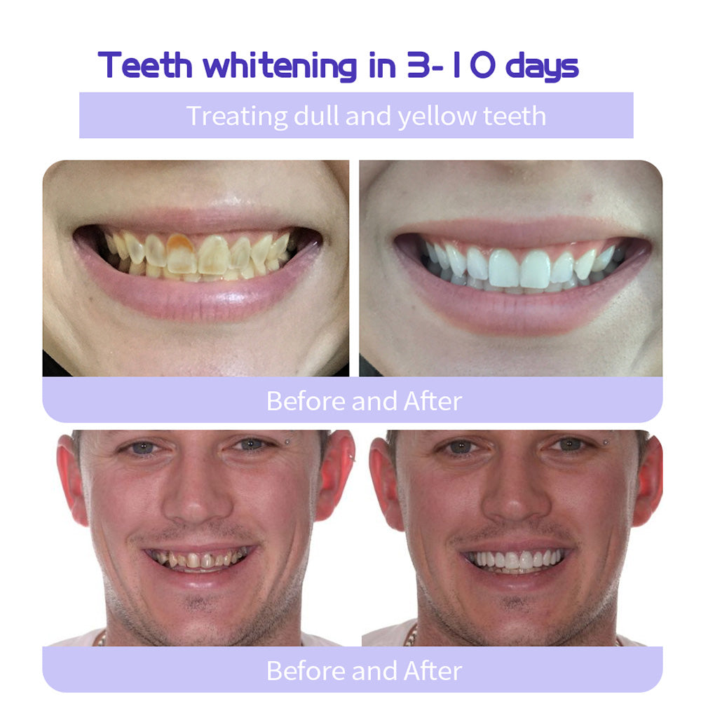 🔥Ends Tonight: Get 60% OFF Before It’s Gone!🎁 Natravor™ Fluoride-Free Hydroxyapatite Toothpaste – Gentle Whitening & Enamel Strength for Sensitive Teeth