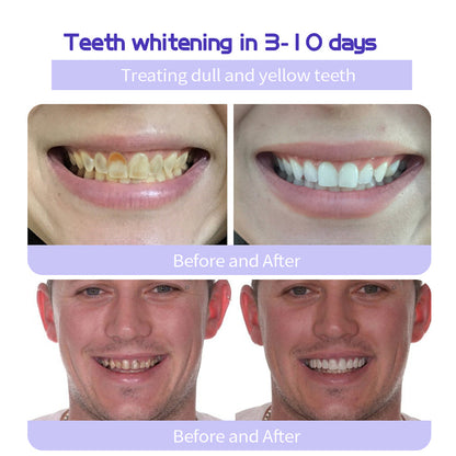 🔥Ends Tonight: Get 60% OFF Before It’s Gone!🎁 Natravor™ Fluoride-Free Hydroxyapatite Toothpaste – Gentle Whitening & Enamel Strength for Sensitive Teeth