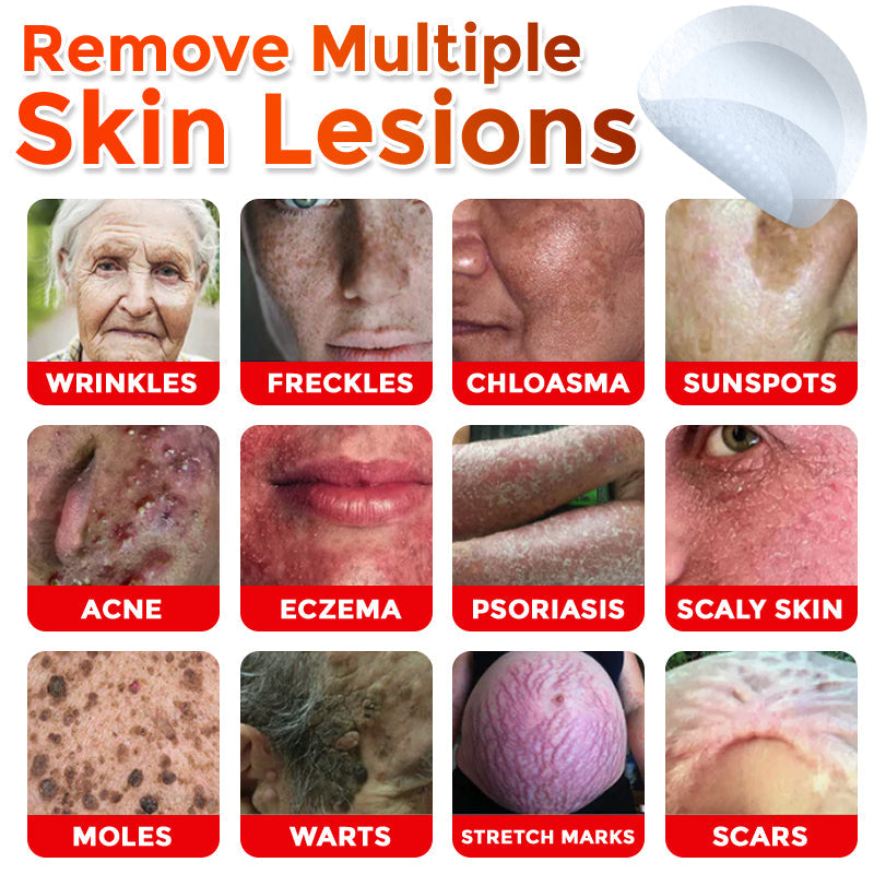 🔥🔥Natravor™-MicroNeedle Plant-based Skin Tag Removal Patch 🇺🇸 Made in the USA
