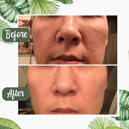 🔥🔥GREEN TEA MASK | DEEP PORE CLEANSER