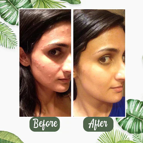 🔥🔥GREEN TEA MASK | DEEP PORE CLEANSER
