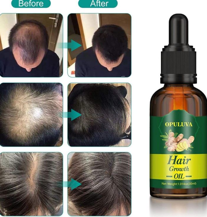 🔥🔥Nourish your scalp & support stronger-looking hair