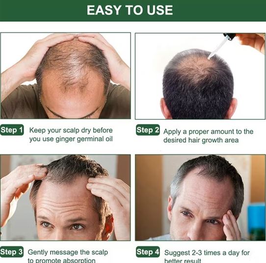 🔥🔥Nourish your scalp & support stronger-looking hair