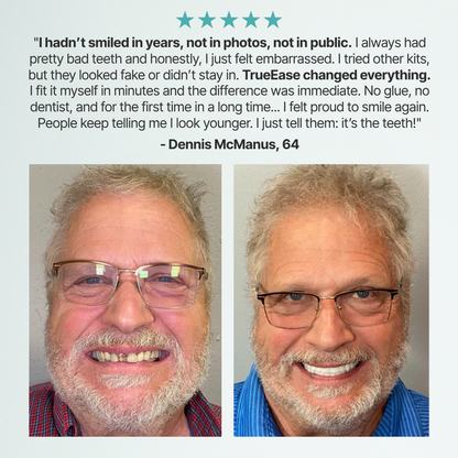 ✨Custom-Fit Full Functional Dentures