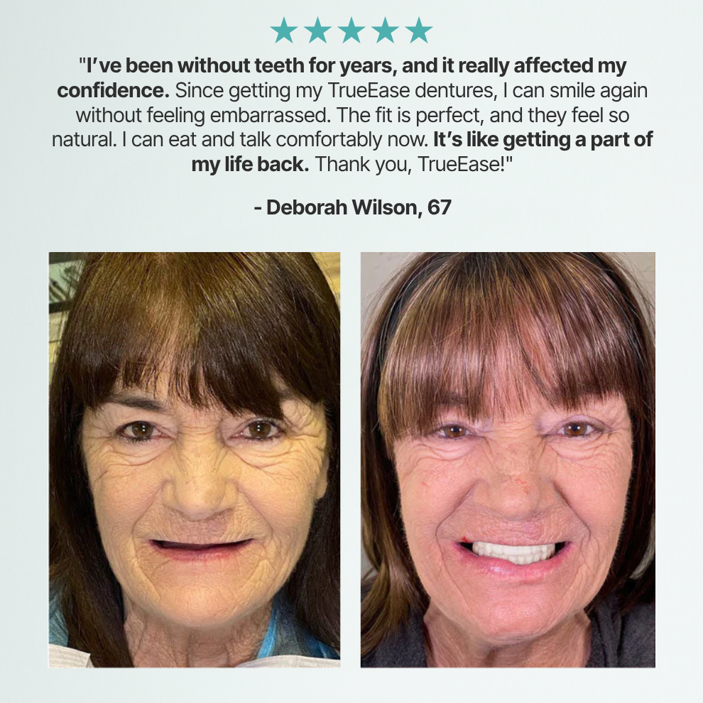 ✨Custom-Fit Full Functional Dentures