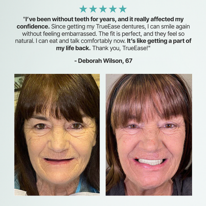 ✨Custom-Fit Full Functional Dentures
